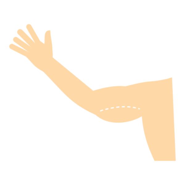 arm