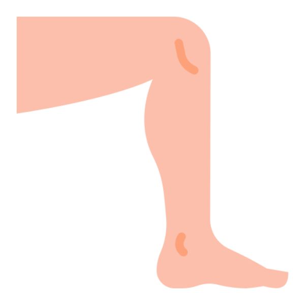 leg